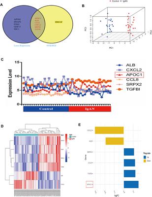 APOC1 exacerbates renal fibrosis through the activation of the NF-κB signaling pathway in IgAN